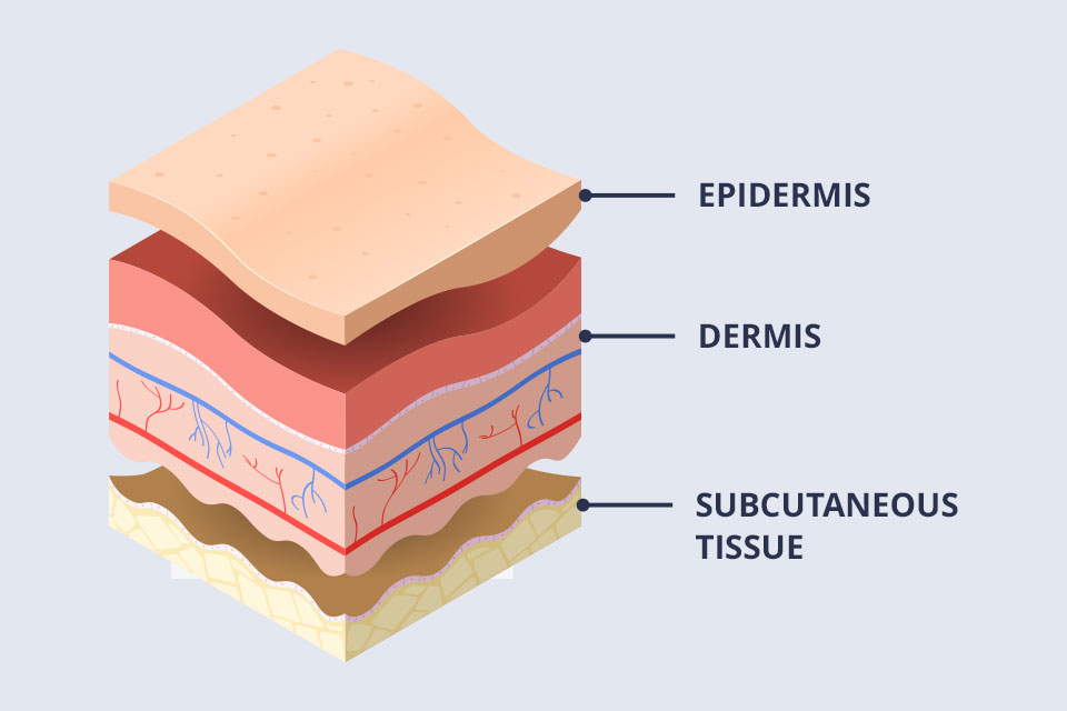 layers-of-the-skin layers of the skin