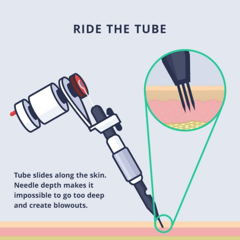 ride the tube tattoo needle staying above the fat layer