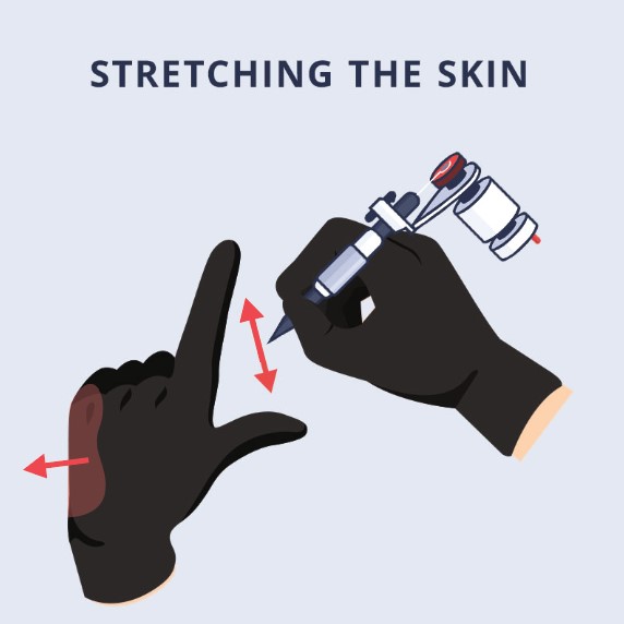 stretch on the skin surface how to get a very tight stretch on the skin surface