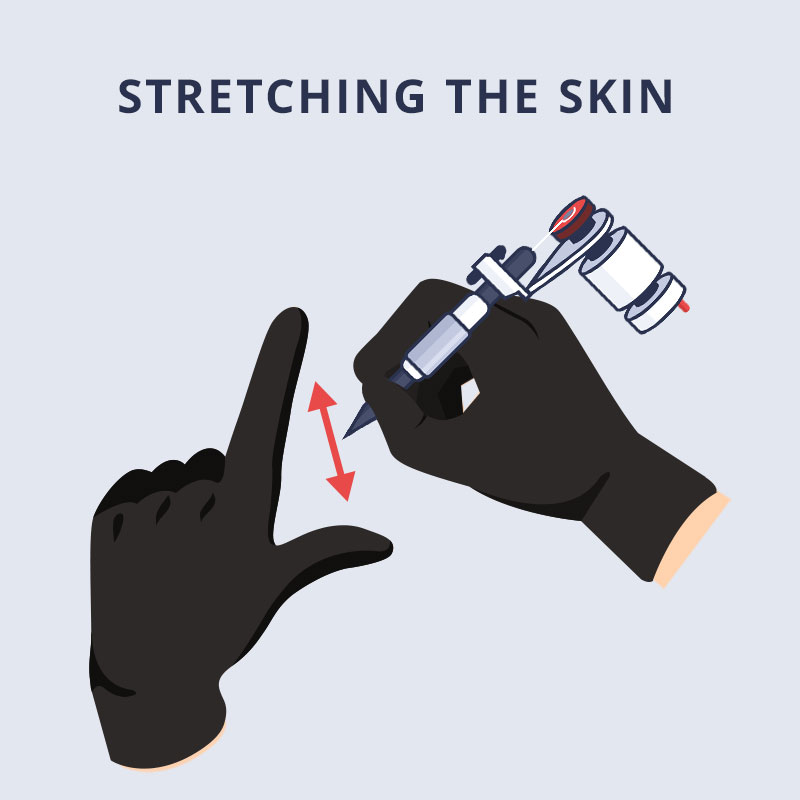 stretching_the_skin_01_B