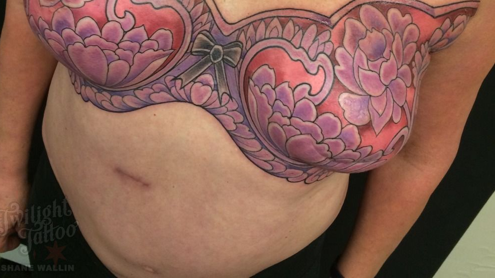 tattoo mastectomy scar
