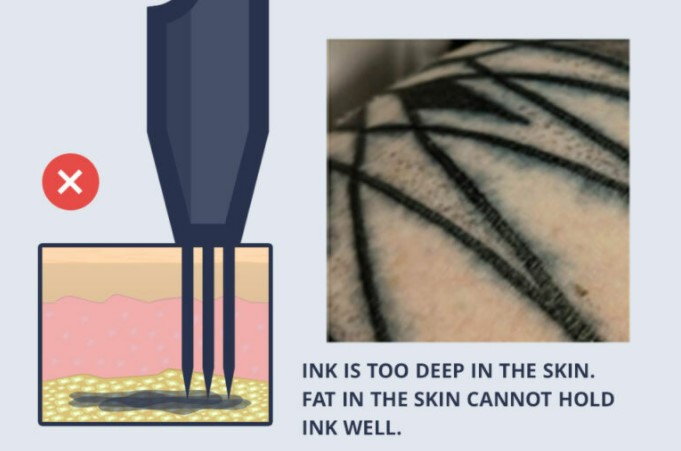 tattoo needles placed too deep into the skin tattoo needles placed too deep into the skin