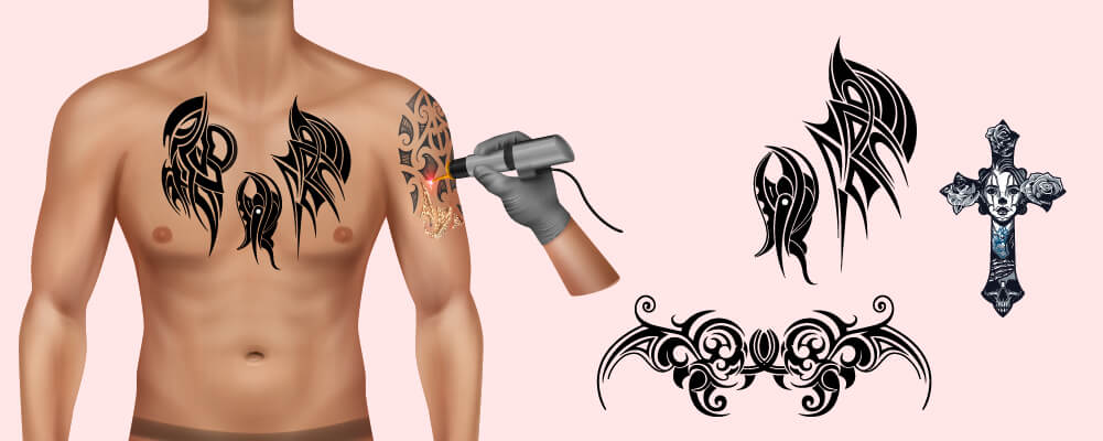 Tattoo trends in the 20th century Man getting tattoo removal via lazer