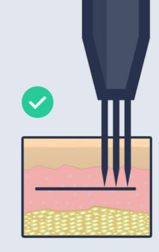 black lines in the skin graphic tattoo artist tattoos black lines in the skin