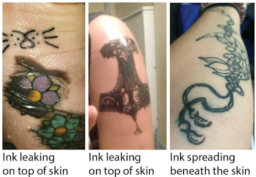 excess ink will leak out during the tattoo healing process excess ink will leak out during the tattoo healing process